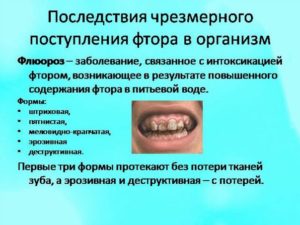 Фторид в зубной пасте польза или вред