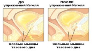 Прерывание мочеиспускания у мужчин польза и вред