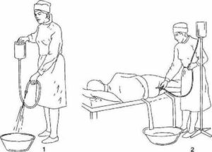 Польза и вред клизмы для очищения кишечника