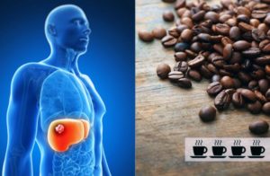 Как кофе влияет на печень человека польза и вред?