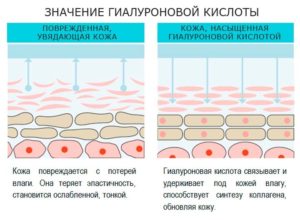 Гиалуроновая кислота для кожи лица польза и вред