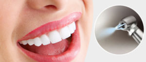 Air flow чистка зубов вред и польза